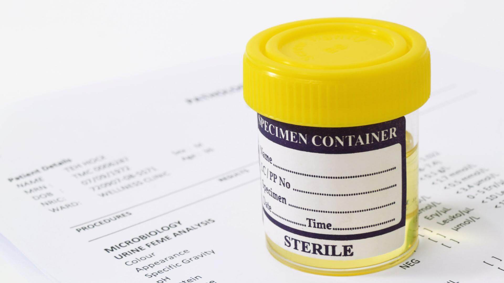 Your Guide to Passing a Urine Drug Test
